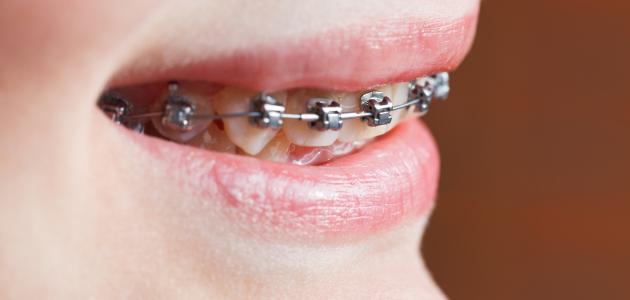 Orthodontics